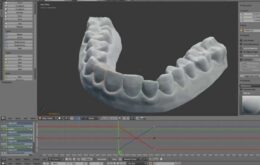 Como um estudante imprimiu o próprio alinhador dental em 3D