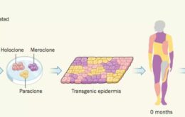 Cientistas recriam 80% da pele de uma criança e salvam sua vida