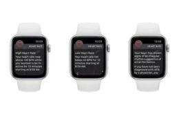 Apple Watch ganha recurso de eletrocardiograma e alertas de arritmia cardíaca