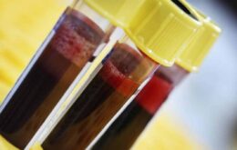 Cientistas estudam transfusão de anticorpos para conter coronavírus