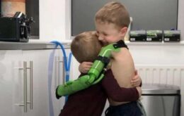 Menino abraça irmão pela primeira vez após ganhar prótese de braço