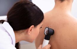 Brasileiros aprimoram software para detecção de câncer de pele
