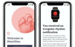 Apple Watch será avaliado sobre capacidade de reduzir riscos de AVC