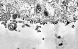 Cientistas dizem ter encontrado células humanas mais vulneráveis ao novo coronavírus
