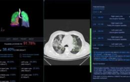 Inteligência artificial será usada na detecção da doença