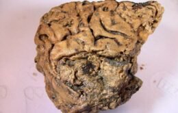 Tecido cerebral humano sobrevive intacto por 2.600 anos; veja como