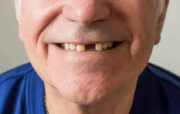 Covid-19: recuperados relatam perda de dentes saudáveis